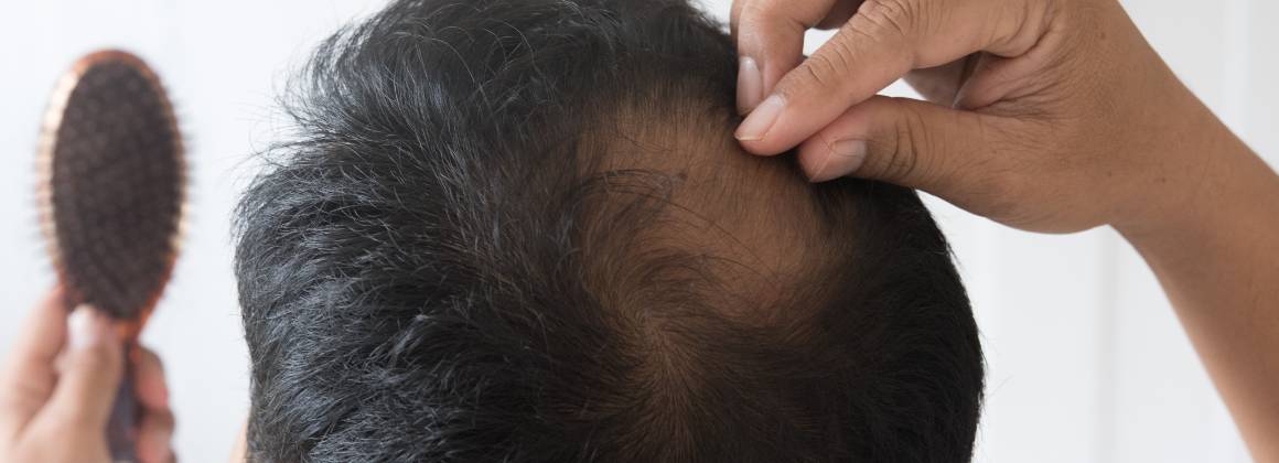 Quais são as causas da raleadura e da queda de cabelo?