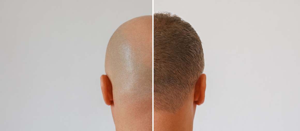Como fazer o seu cabelo crescer mais depressa?