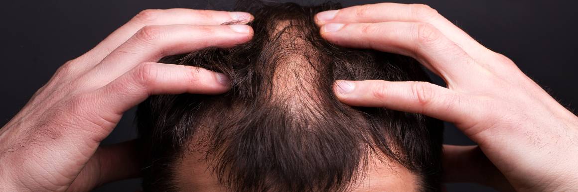 Reparação dos folículos capilares danificados para um crescimento saudável do cabelo